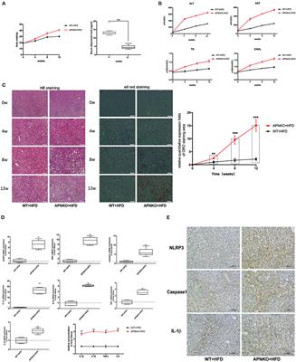 Adiponectin Inhibits NLRP3 Inflammasome Activation in Nonalcoholic Steatohepatitis via AMPK-JNK/ErK1/2-NFκB/ROS Signaling Pathways